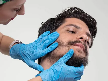 thin patchy beard man wants hair transplant