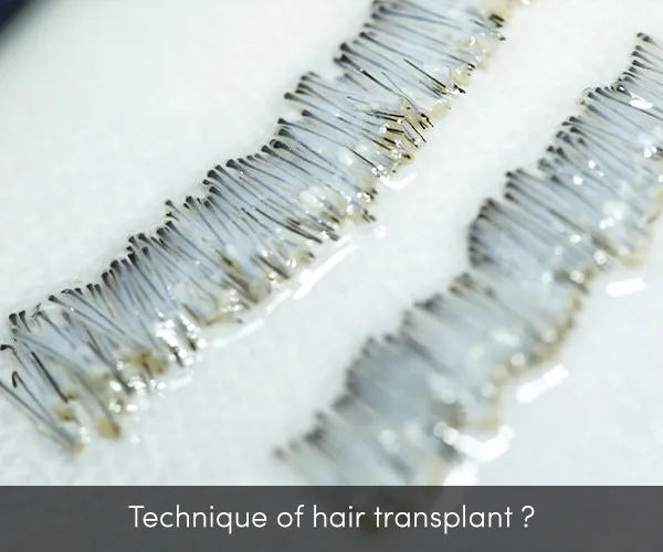hair grafts kept in advanced solution for maximum hair density