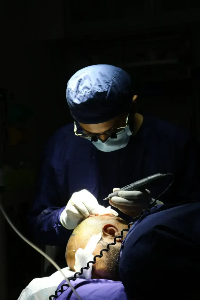 doctor ankit khasgiwala taking out hair grafts by sapphire technique without causing any damage to hair follicles