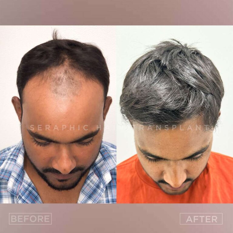 Ajay bhardwaj 3_1_11zon