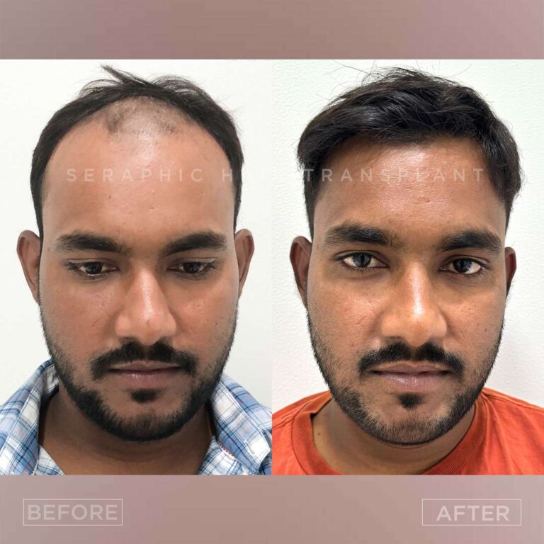 Ajay bhardwaj 4_2_11zon