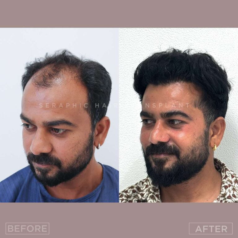 Untitled-psd bf-rt_14_11zon