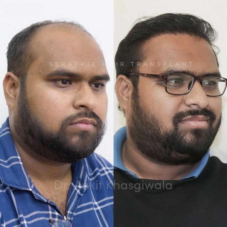 shreyash new021_8_11zon