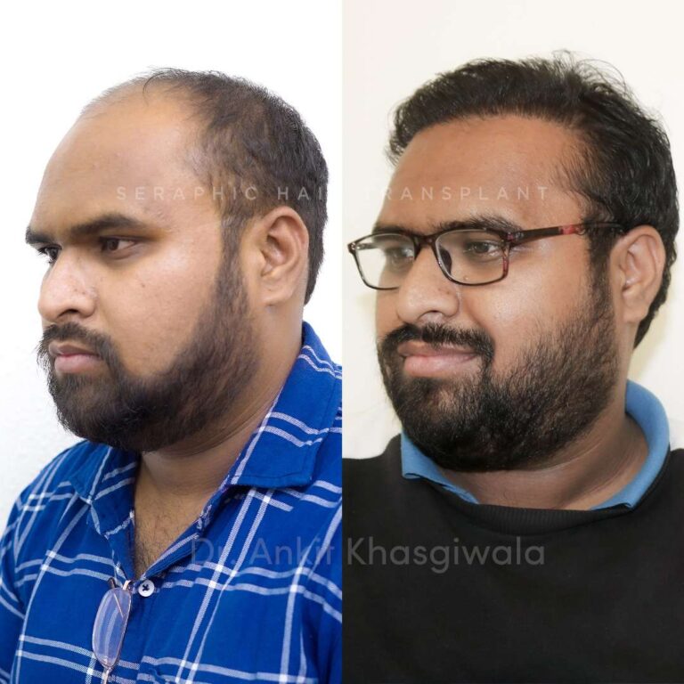 shreyash new022_9_11zon