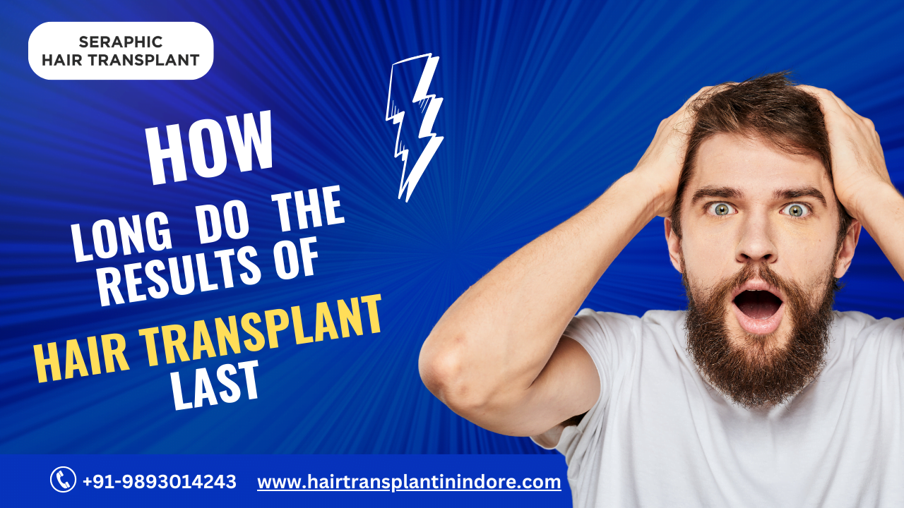 Hair transplant results last