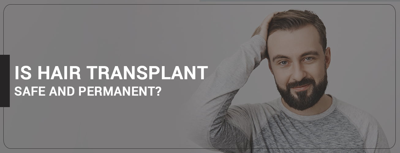 hair transplant permanent solution