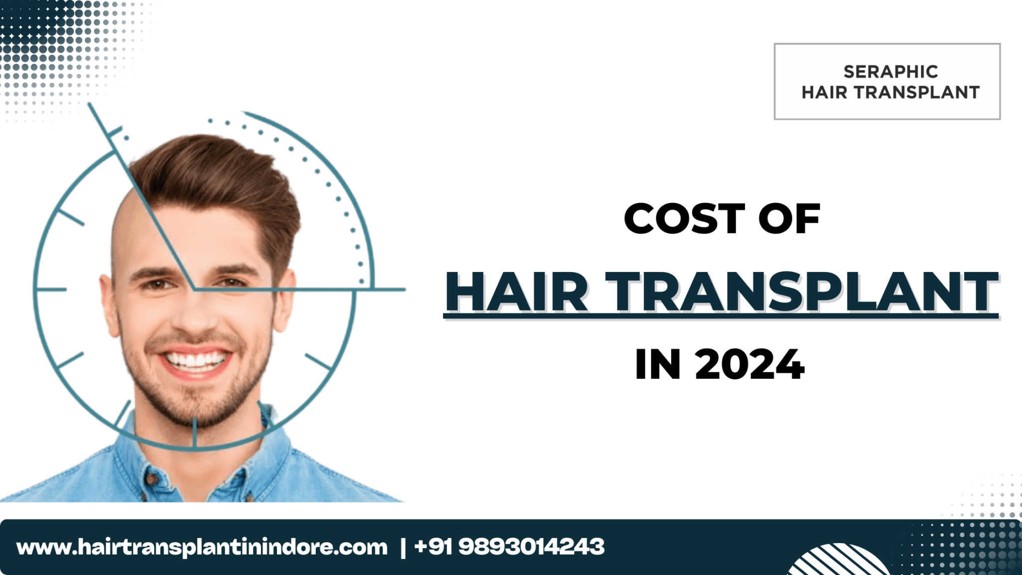 cost of hair transplant in indore