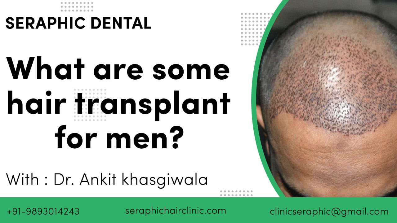 hair transplant for men