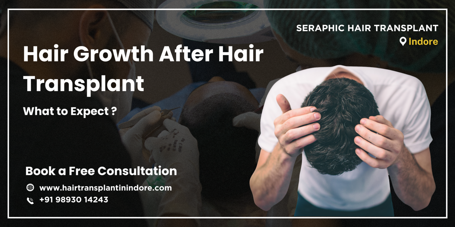 hair-growth-after-hair-transplant