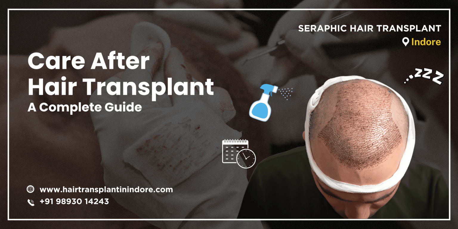 care-after-hair-transplant