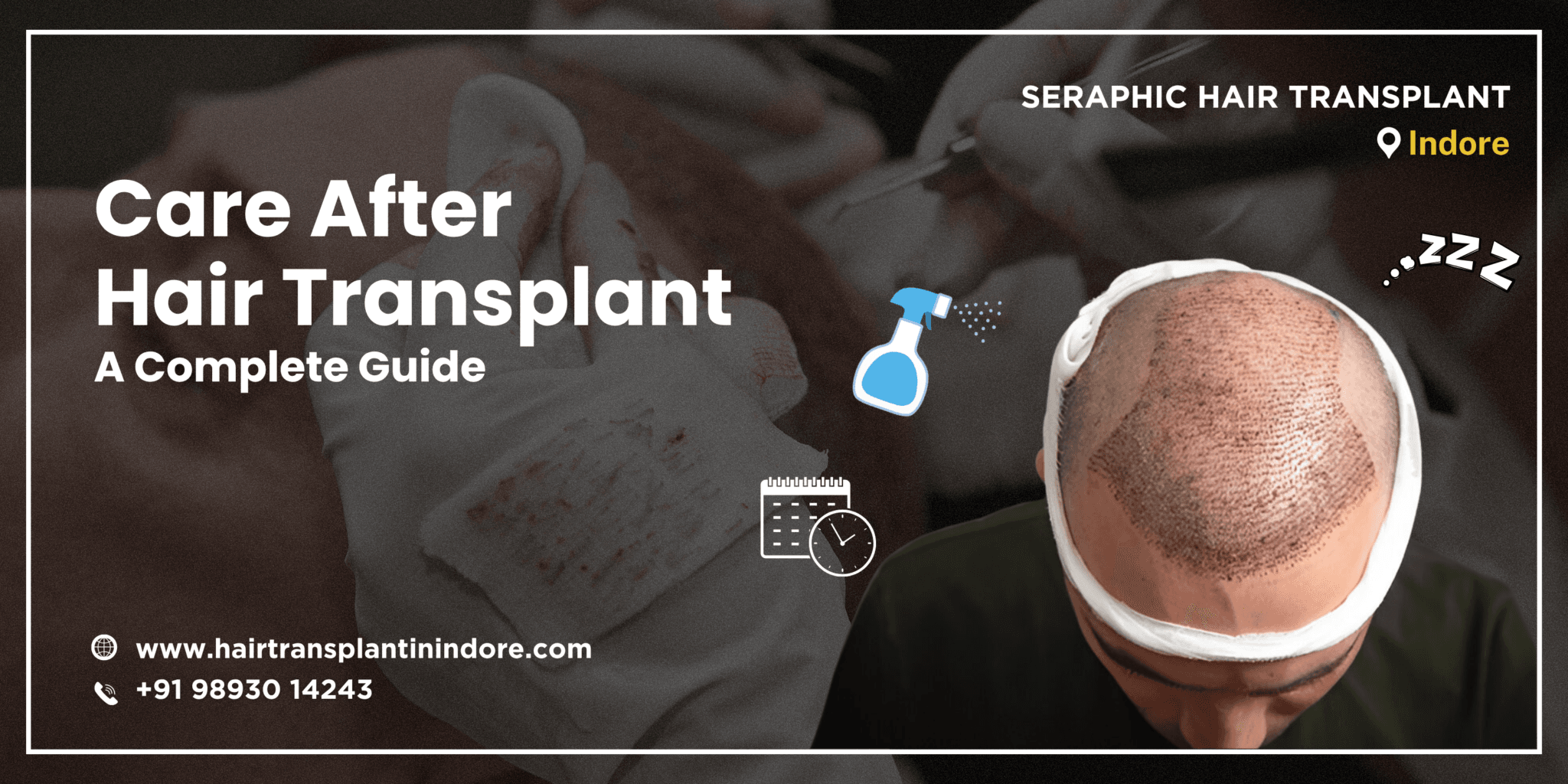 care-after-hair-transplant