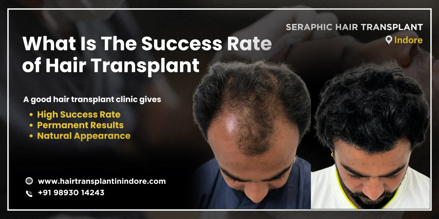 Hair-Transplant-scaled