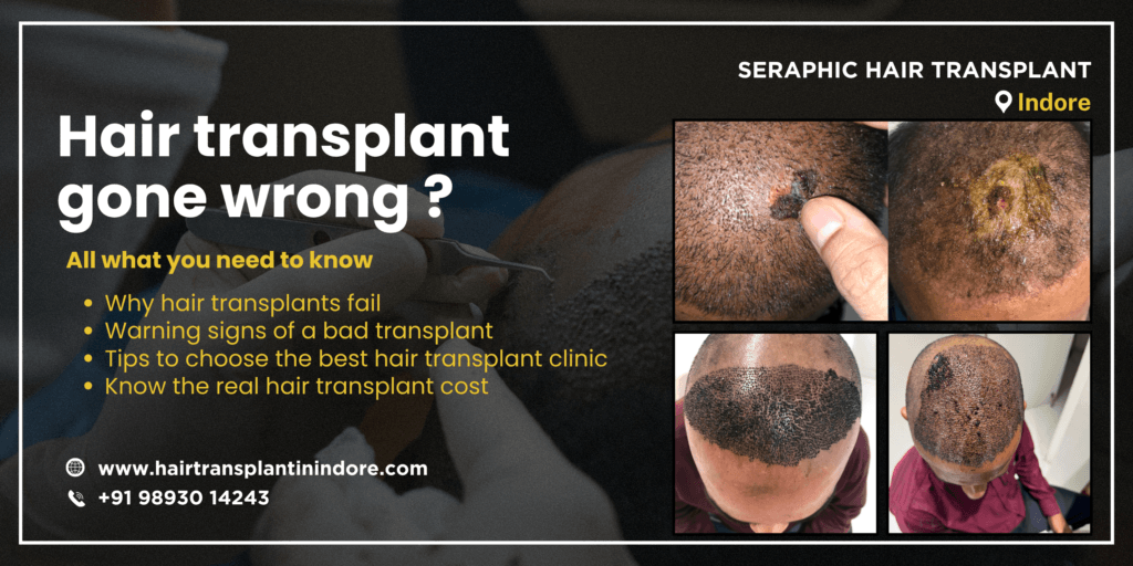 hair-transplant-wrong