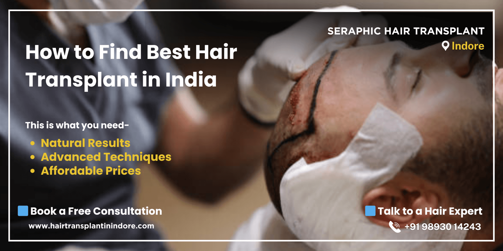 hair-transplant-in-india