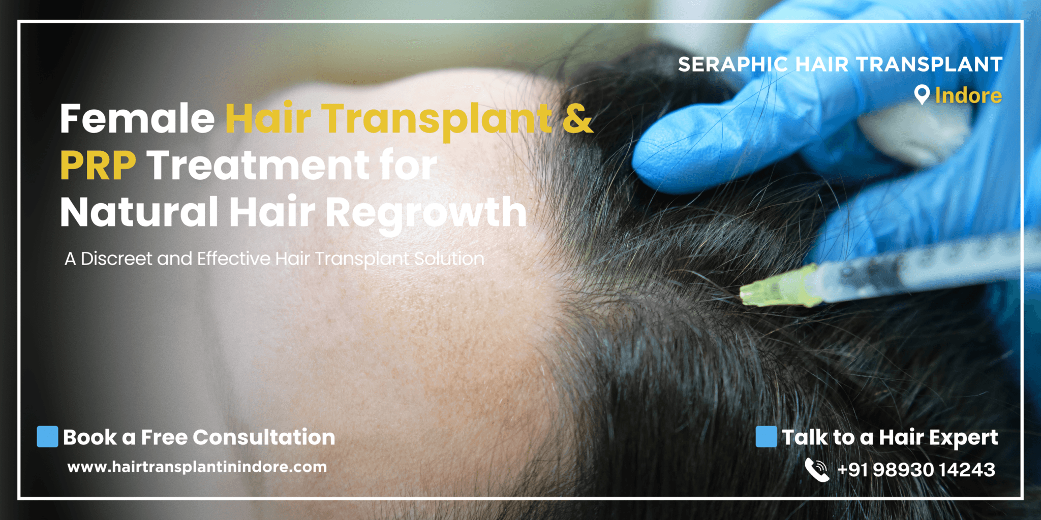 female-hair-transplant