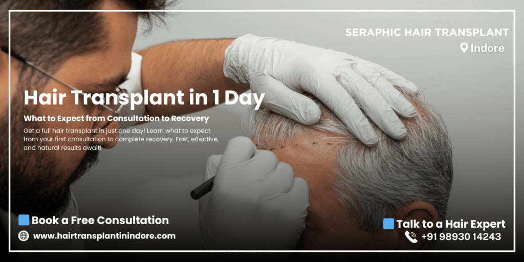 hair-transplant-in-1-day