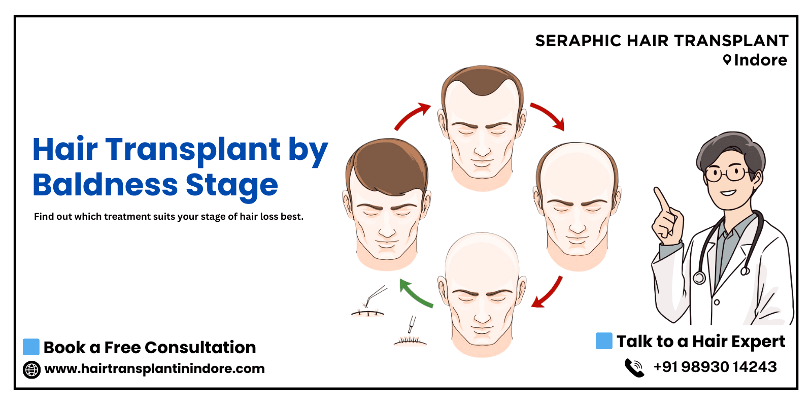 hair-transplant-center-in-Indore
