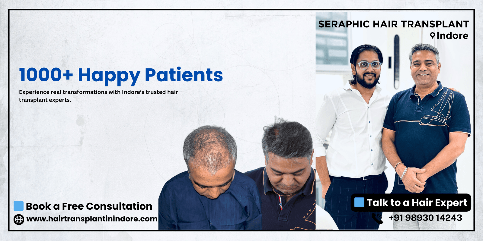 best-hair-transplant-center-in-Indore